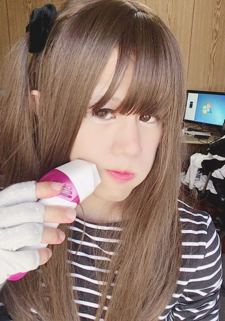 ケノンでひげ脱毛