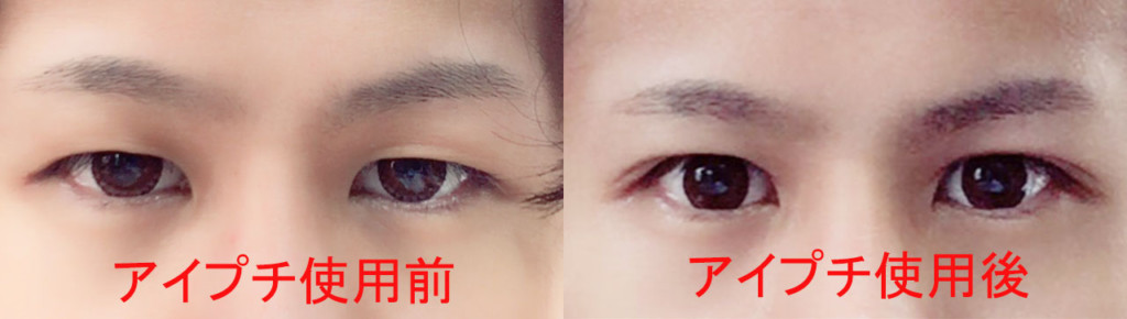 アイプチ比較