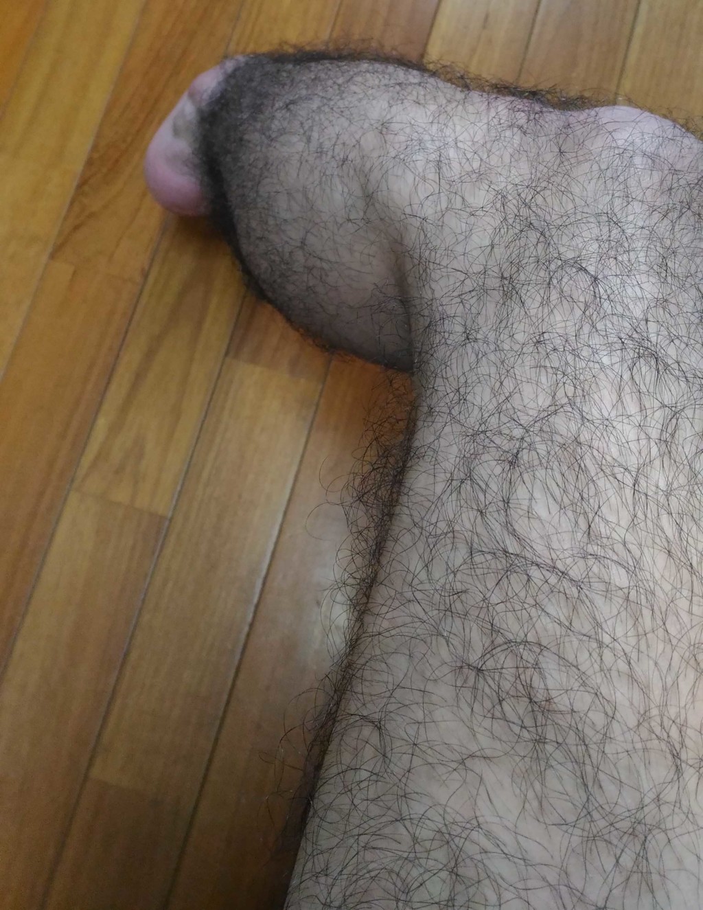 足のムダ毛