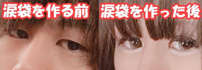 男の目元と涙袋完成後の比較