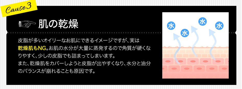肌の乾燥